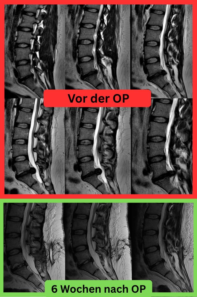 Wenn der Körper die Notbremse zieht. BSV OP Kopie 682x1024