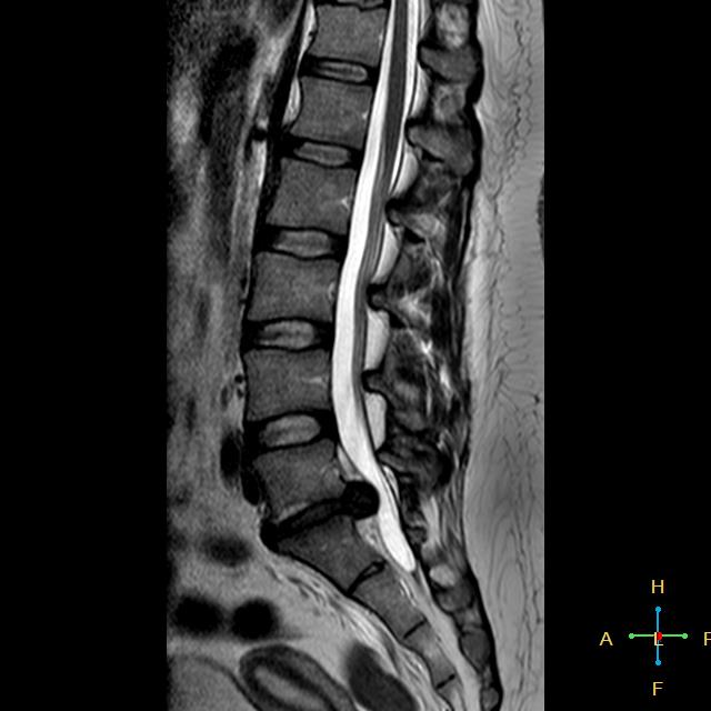 Wenn der Körper die Notbremse zieht.